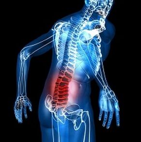 Osteochondrosis