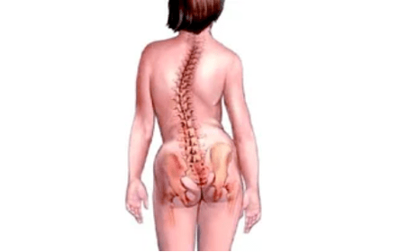důvody pro rozvoj cervikální osteochondrózy