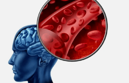 příznaky osteochondrózy krční páteře